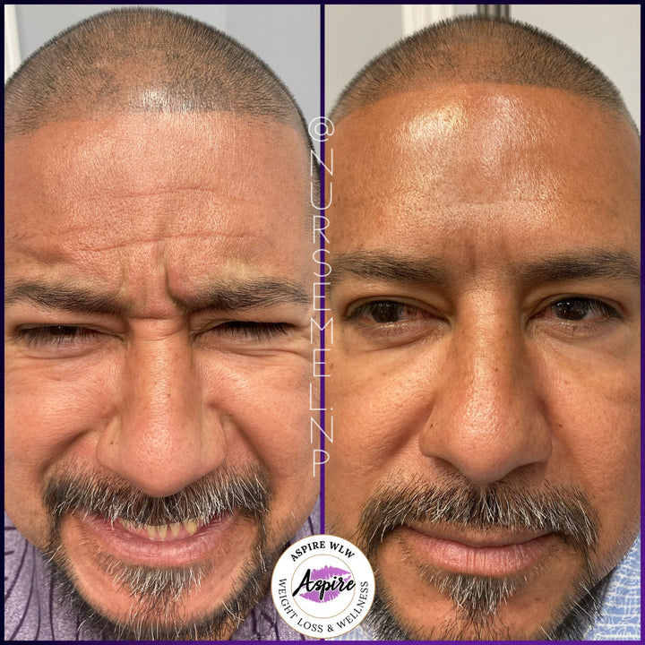 VIP Botox Membership